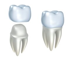 louisville, ky dentist